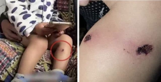 이스라엘군, 18개월 아기 '담뱃불' 고문 논란 확산…아버지 자백받으려 가혹 행위