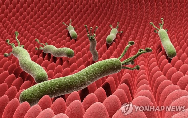 "헬리코박터균 없애도 비만이면 위암↑…55세 이후 제균자 주의"