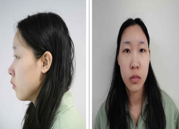 이수정 "김소영 IQ 하위 10%…사이코패스 진단 신중해야"