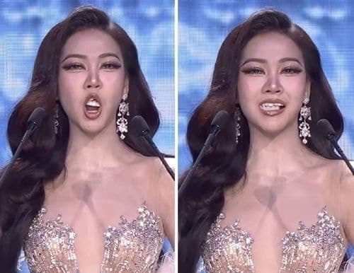 “잠깐 치아 좀 낄게요” 미인대회 도중 보철물 떨어진 참가자…침착한 대처에 ‘환호’