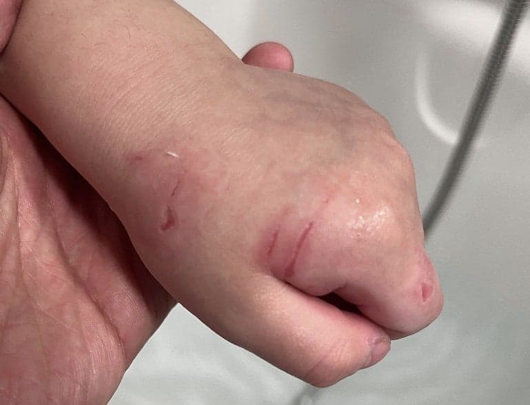 "시끄럽다고 4살배기 원아 손 할퀸 보육교사"…어린이집 CCTV 충격 장면