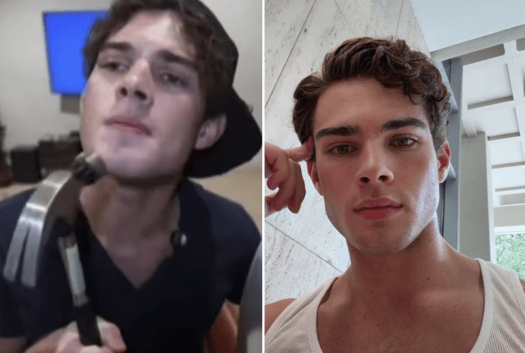 “완벽한 턱선 만들려 망치로 얼굴 퍽”…MZ세대서 확산하는 ‘룩스맥싱’ 논란