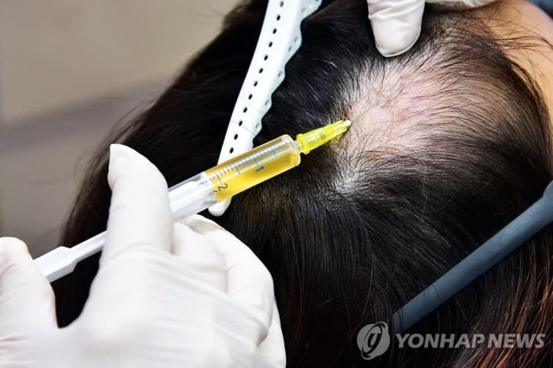 복지부 "청년 탈모치료 건보지원 확정된 바 없어…효과 따져야"
