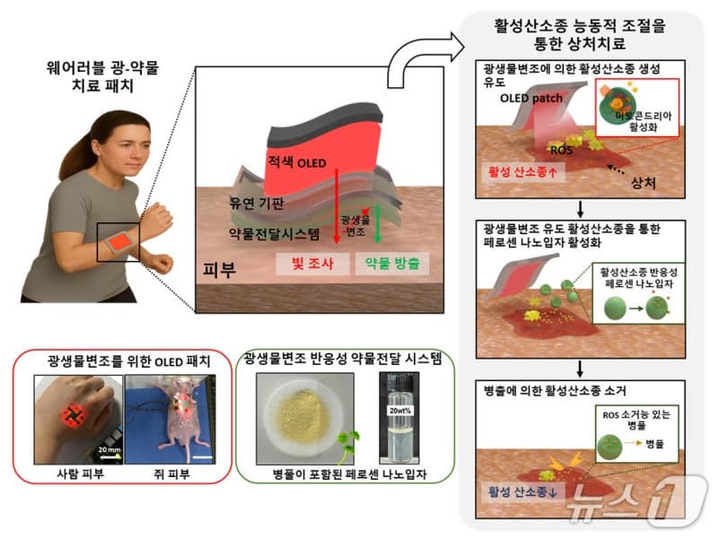 “피부에 착 붙이면” 상처 치료속도 2배↑…KAIST, 빛으로 약물 자동 조절하는 스마트패치 개발