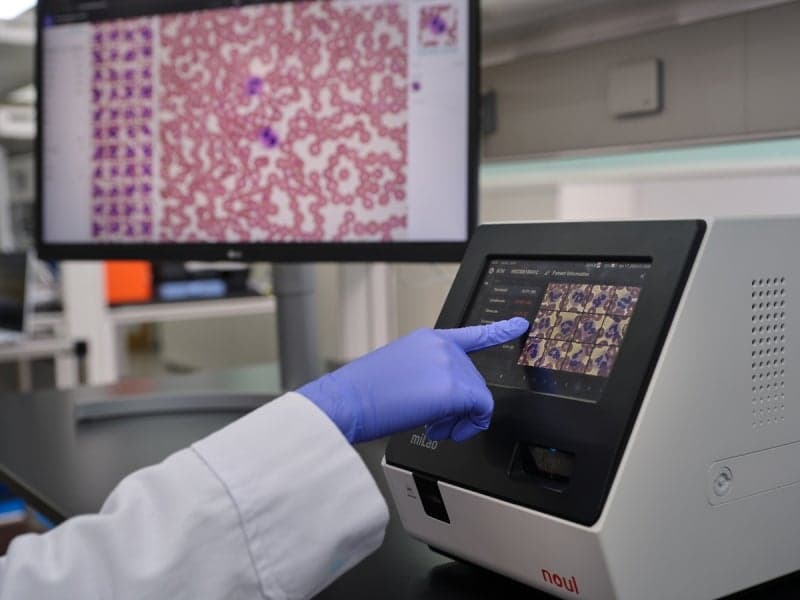 노을, 美 재생의학 기관과 MOU…AI 혈액분석 줄기세포 진출