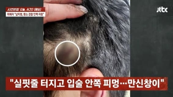 "형님, 신고 들어왔는데요" 납치·폭행 사채업자에게 전화 건 경찰 '수사 배제'