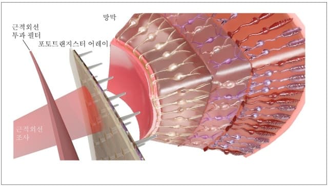 “보이지 않던 근적외선까지 본다”…인간 한계 넘은 '이식형 인공망막' 개발