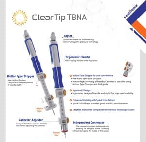 파인메딕스, 기관지 내시경 시술기구 美 FDA 승인…“글로벌 사업 확장”