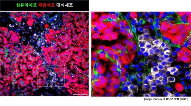 GIST, 폐암 세포 연쇄 반응 구조 세계 최초 규명…“암 발생 전부터 몸은 암세포 성장 최적 환경으로 변한다”