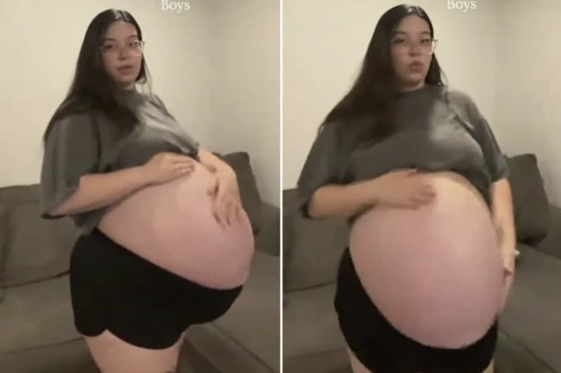 “배 속에 골프장 있나?”…쌍둥이 임신에 ‘초대형 배’ 화제, 조회수 2200만