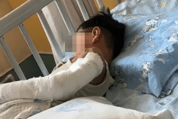 "엄마 너무 보고 싶어서" 11층 추락 4살 中아이, 생존율 5% 기적 뚫고 회복