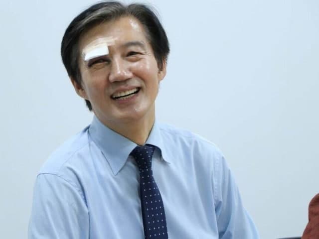 “작은 사고” 눈에 멍든 조국, “멍든 눈으로도 뚜벅이 계속”