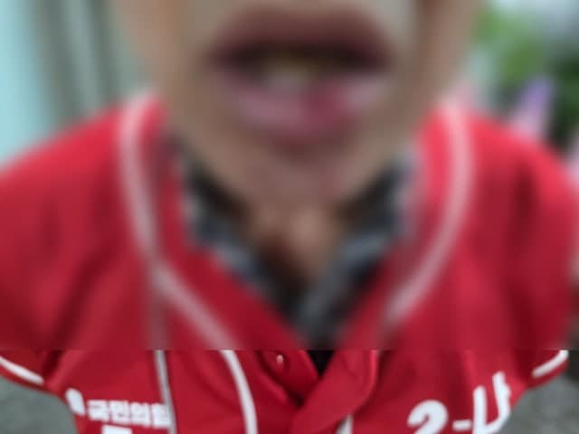대구 수성구서 국민의힘 선거운동원 유세 중 폭행당해 경찰 수사
