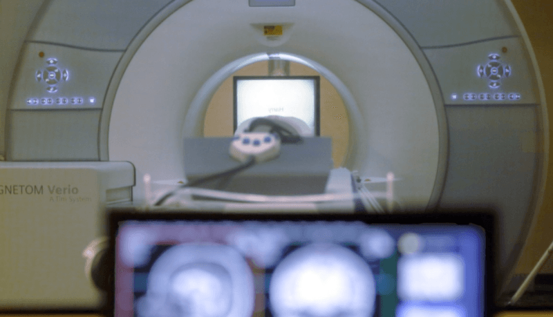 MRI 전문의 주 1일 근무 허용, 운영 문턱 낮추고 지방병원 검사 공백 줄인다