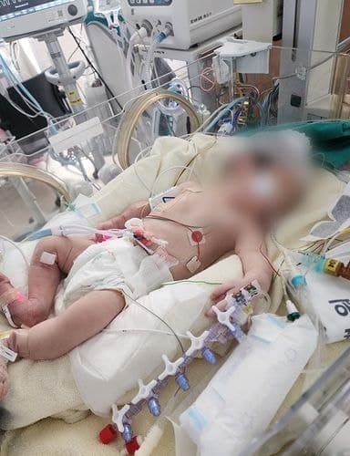 군포 산부인과서 출생 후 '중태' 빠진 아기 두 달 만에 숨져…경찰, 의료진 과실 여부 수사