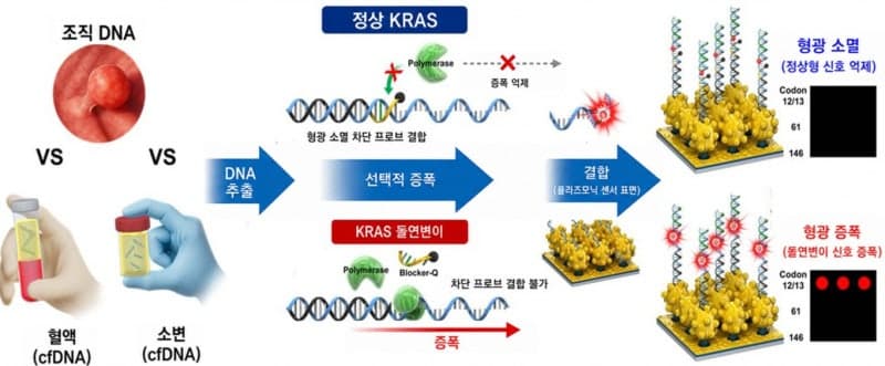 재료연, "혈액·소변으로 초기 대장암 암유전자 검출" 액체생검 플랫폼 개발