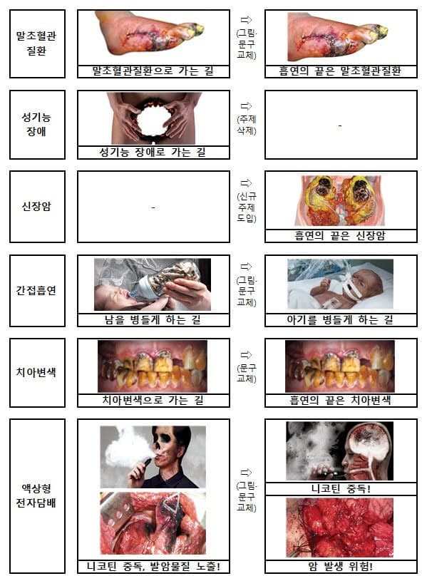 "흡연의 끝은 폐암"…담뱃갑 경고 문구 12월부터 더 독해진다, 신장암 추가