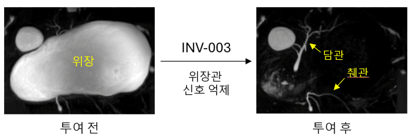 인벤테라, '먹는 MRCP 조영제' 비임상 패키지 완성…연내 IND 제출