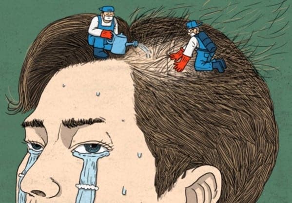 복지부, '탈모 건보 적용' 국민 토론회 전격 취소…비판 여론에 공론화 속도조절