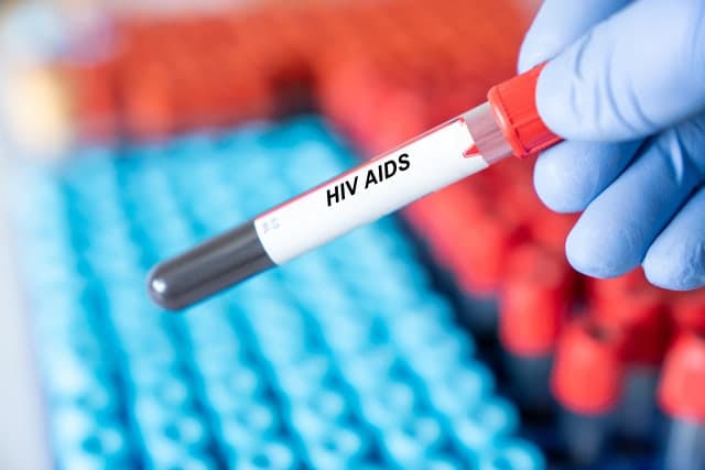 신규 HIV 감염 3년 연속 감소…2030세대 66%, 99%가 '성 접촉'