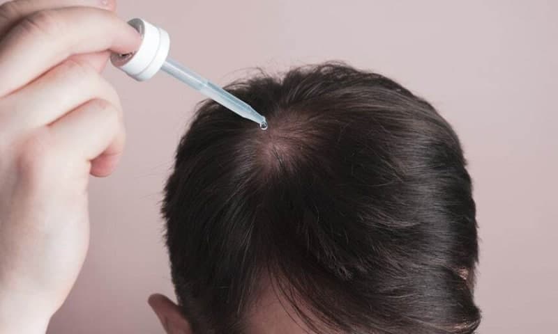 정부, '탈모 치료제 건보 적용' 토론회 돌연 취소… 비판 여론·재정 악화에 부담