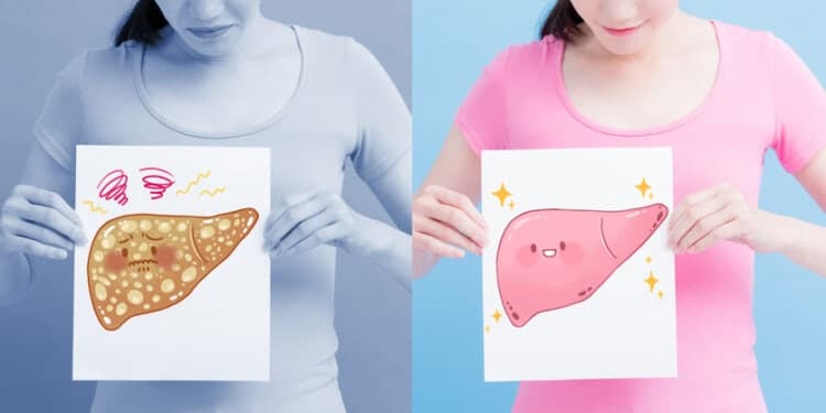 "우울증 있으면 지방간 증가"…젊은 여성 특히 위험, 45세 미만 조심해야