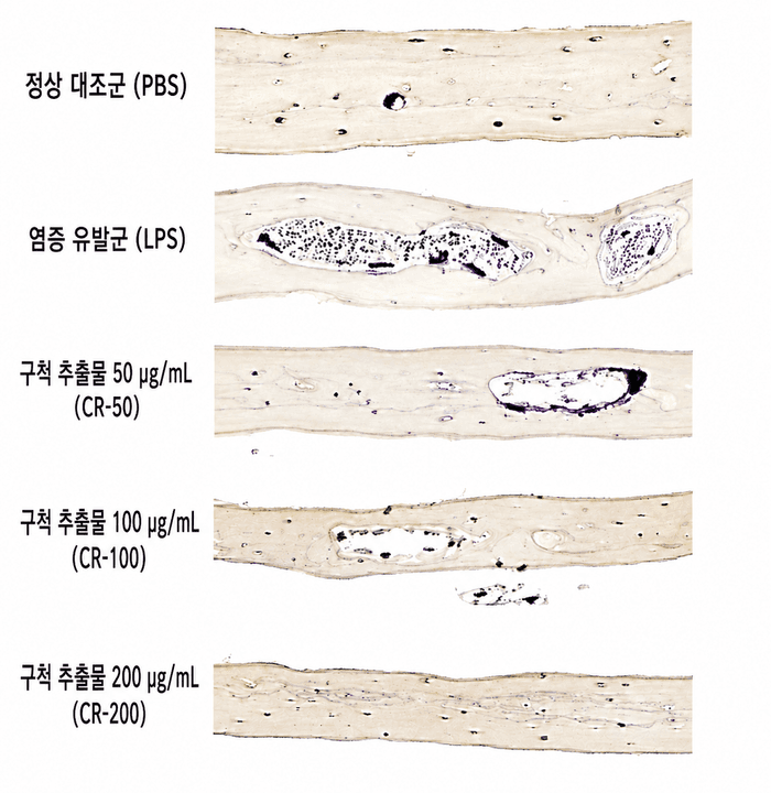 "염증으로 녹는 뼈, '구척'으로 막는다"…자생한방병원, 염증성 골소실 억제 효과 규명