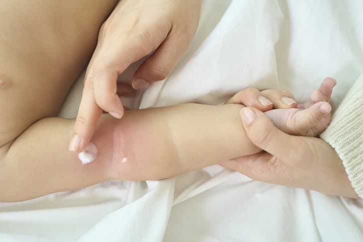 “임신 중 플라스틱 노출” 아기 아토피 유병률 높인다…생후 1년내 발생 최대 8배