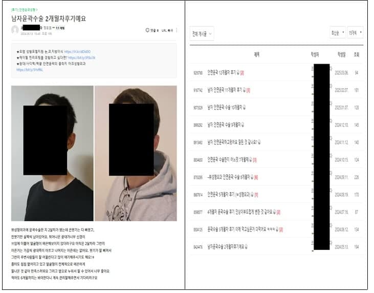 수술비 할인받고 쓴 후기?…강남 성형외과 3곳 ‘뒷광고’ 제재
