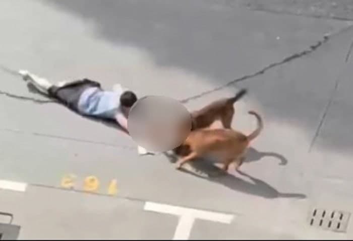 아파트 단지서 아이 물고 끌고 간 개들…몸 던져 막아낸 보호자
