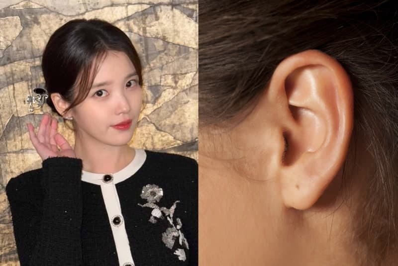 머릿속 숨소리 울리는 '이관개방증'…아이유, 콘서트 취소하고 활동 연기
