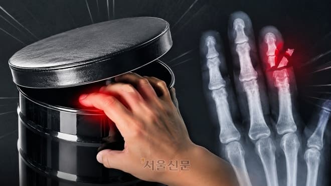 식당 '깡통 의자'의 공포, 손가락 절단 사고 벌써 5명 발생