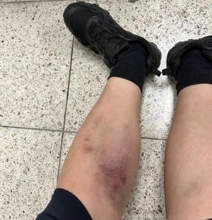 도로 난동 부리고 경찰 폭행한 10대 검거…응급입원 조치