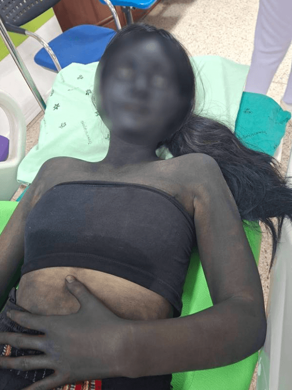 태국 응급실에 나타난 '귀신 분장' 여학생, 의료진 깜짝 놀라게 한 사연은?