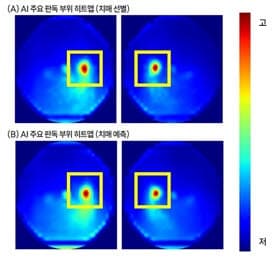 망막 안저 사진 한 장으로 치매 위험 예측하는 AI 모델 개발