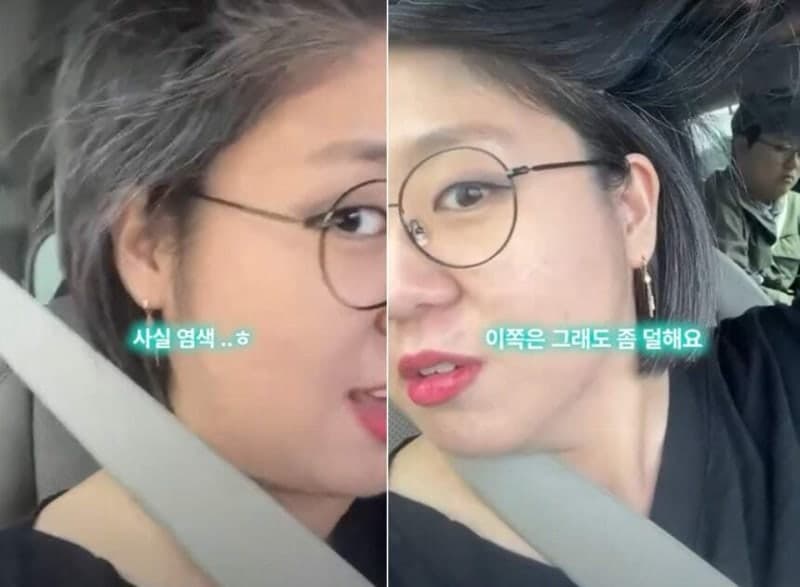 용혜인 '한쪽 흰머리' 정체 재조명…장관 지명 후 겸직 논란까지 확산