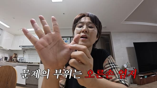 방송인 송은이, ‘방아쇠 수지 증후군’ 수술 고백…손가락 ‘딸깍’ 증상 뭐길래