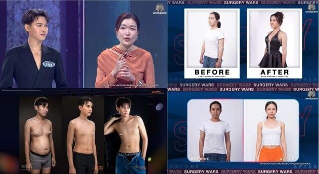 365mc, 태국 메이크오버 프로그램서 K-지방흡입으로 새 삶 선물