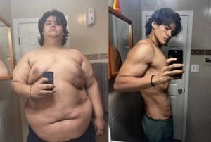 211kg에서 87kg으로, 약물 없이 124kg 감량한 美 20대 남성