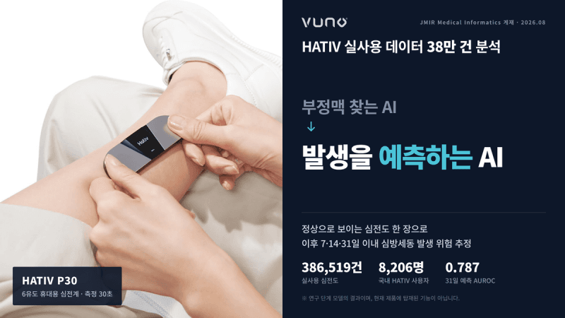 뷰노, 정상 심전도 분석해 한 달 뒤 심방세동 위험 예측하는 AI 개발