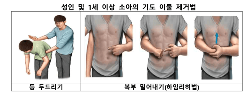 추석 연휴 가정 내 화상·베임·기도폐쇄 사고 평소보다 2배 급증