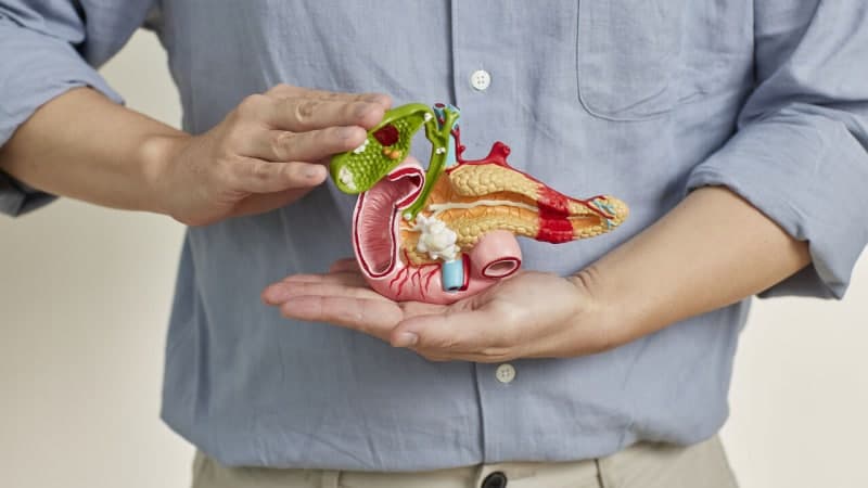 담도암, 암 되기 전부터 변한다…재발·전이 진화 경로 규명