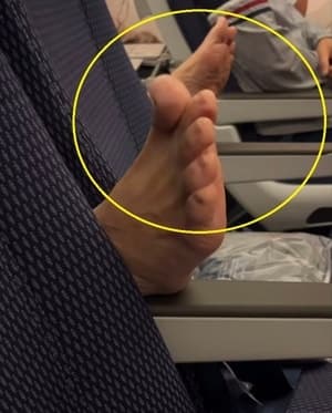 비행기 앞좌석에 맨발 올린 승객, 도 넘은 기내 비매너 논란