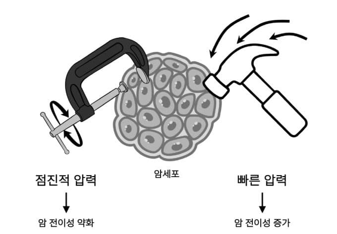 암세포 전이 부르는 '내부 압력' 규명…MRI로 측정하는 초소형 센서 개발