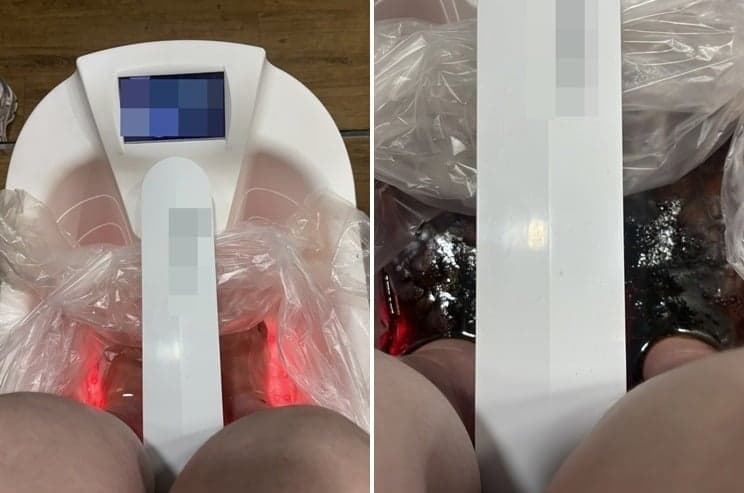 발 담그면 시커멓게 변하는 물, SNS서 난리 난 '디톡스 족욕'의 숨겨진 실체