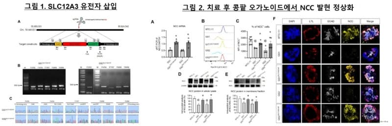 희귀 콩팥병 기텔만 증후군, 유전자 가위로 치료 가능성 열었다