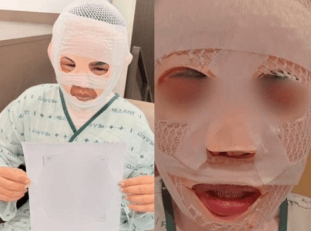 아내 얼굴에 끓는 물 부은 40대 남편, 1500만 원 합의로 2심서 감형