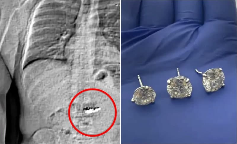 10억 원대 다이아 귀걸이 훔쳐 삼킨 절도범, 결국 유죄 평결